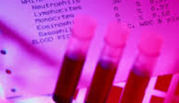 Постгеморрагическая анемия