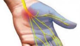 Анемия конечностей