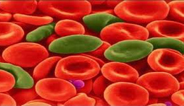 Виды анемии